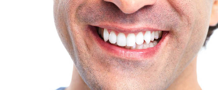 7 choses que votre dentiste ne vous dit pas sur les implants dentaires