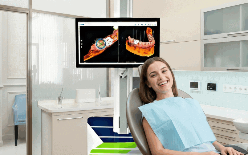 La pose des implants All-on-4 avec navigation X-guide